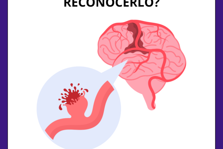 Imagen del ictus hemorrágico